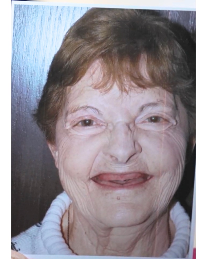 Lois before dental implant treatment - Highland IN patient