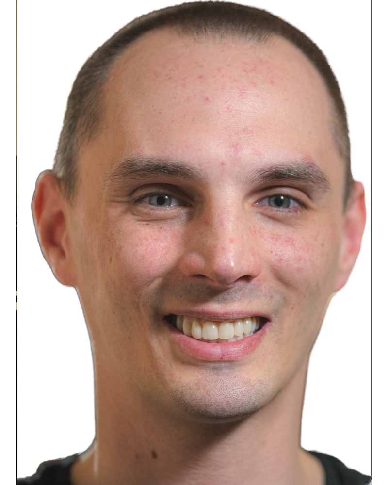 Nick after dental implant treatment - Highland IN results by Dr. Pulver